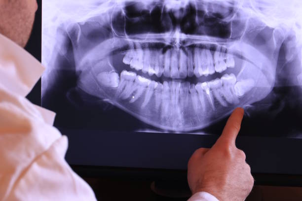 Best Emergency Dental Care for Broken or Chipped Teeth in Storm Lake, IA